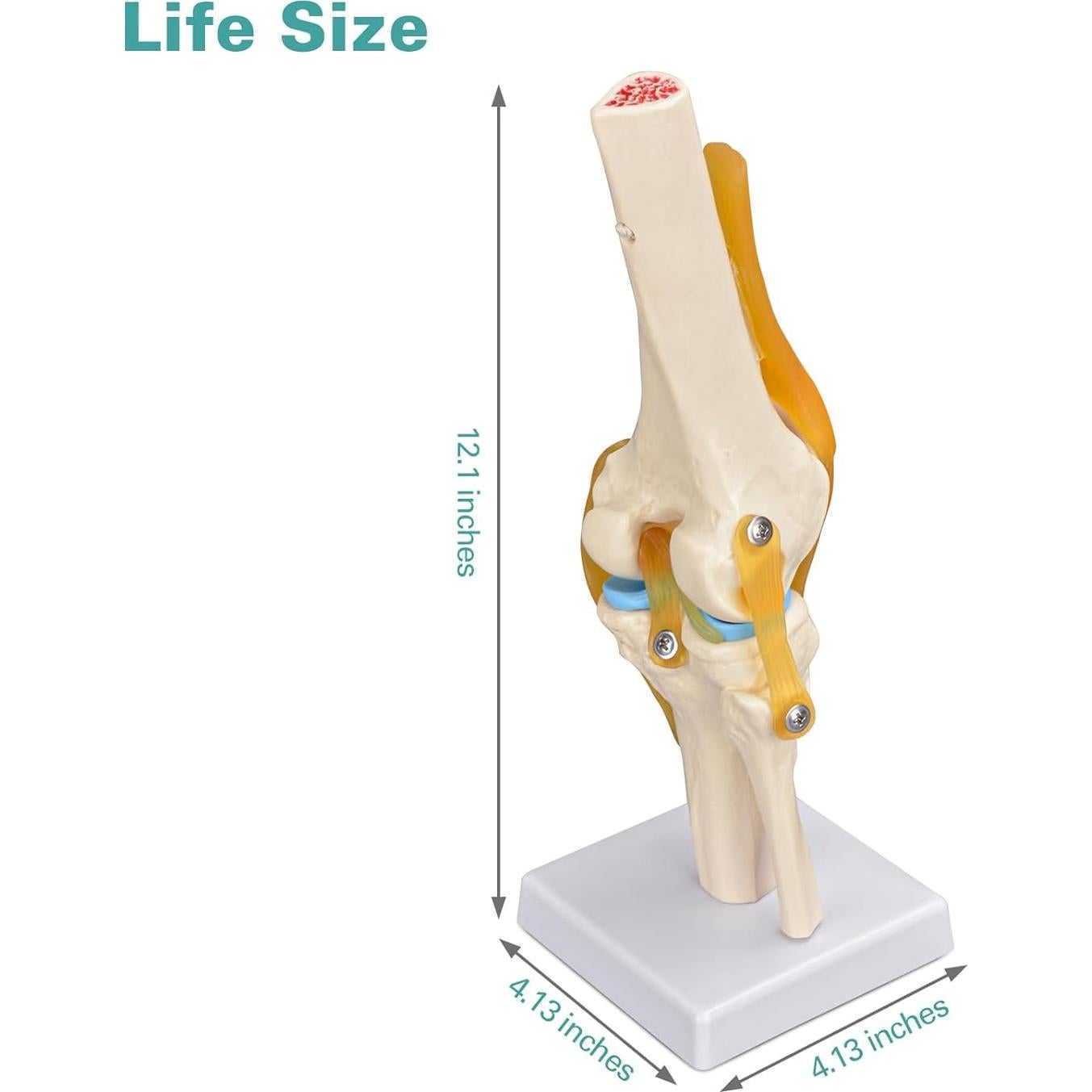 Modelo de Rodilla Humana Ultrassist 1:1 con Ligamentos