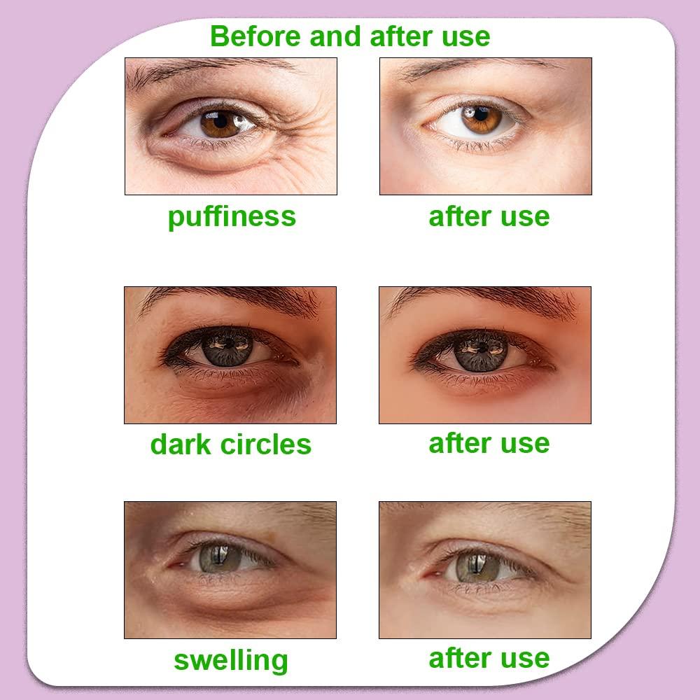 Compresa Ocular Reutilizable Conbella - Calor y Frío 14x7 cm