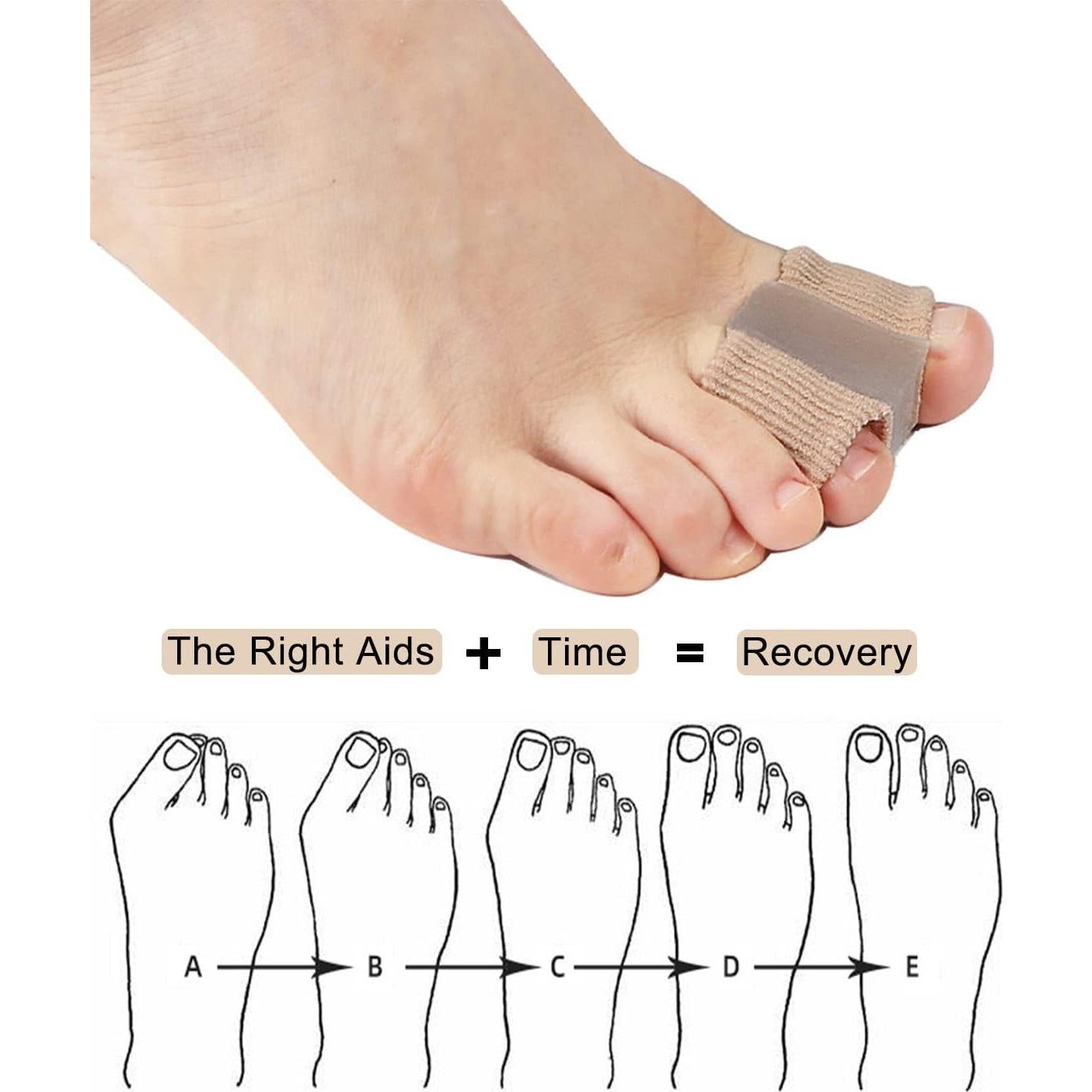 Separadores de Dedos para Juanetes Golbylicc 2PC Gel