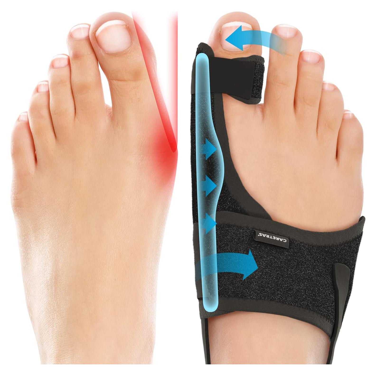 Corrector de Juanetes Caretras Unisex Ajustable 17.5x13.2cm