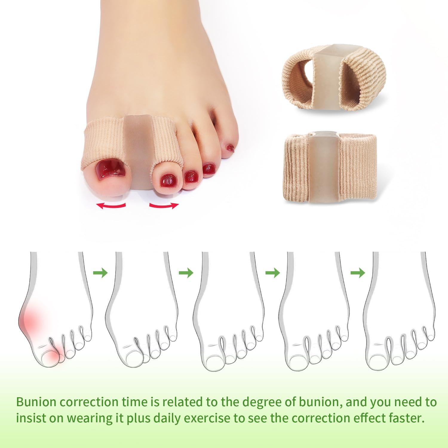 Separadores de Dedos de Bunion Niupiour - Gel Transpirable para Alivio del Dolor