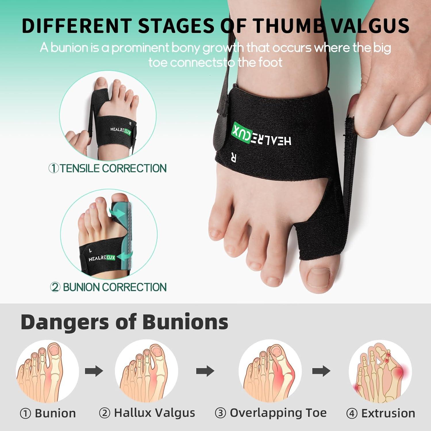 Corrector de Juanetes Healrecux para Dedo Gordo - Alivio y Soporte