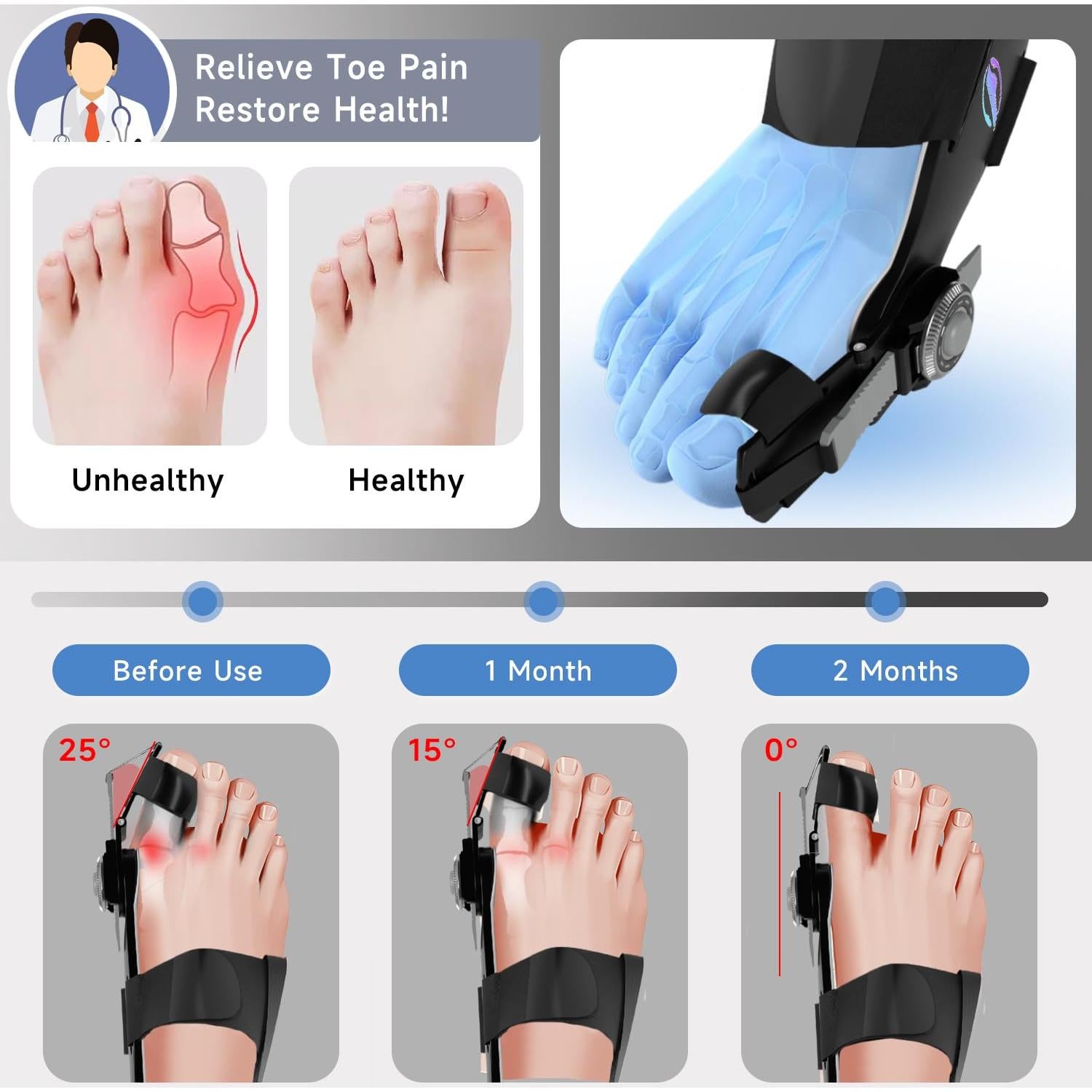 Corrector de Juanetes HUQKIYA Ajustable para Pies Izquierdo/Derecho