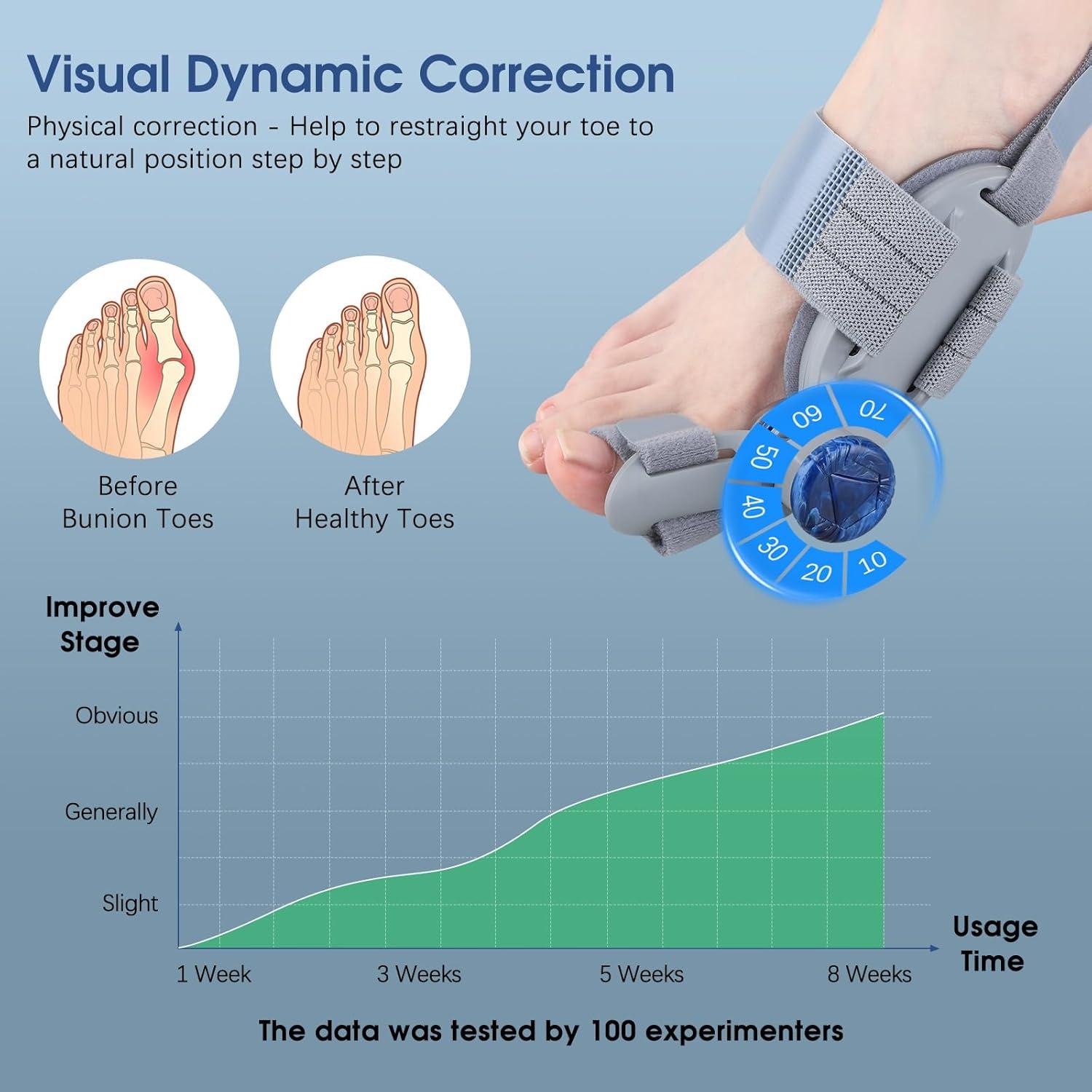 Corrector de Juanetes KASHEVI Ajustable para Alivio Dolor