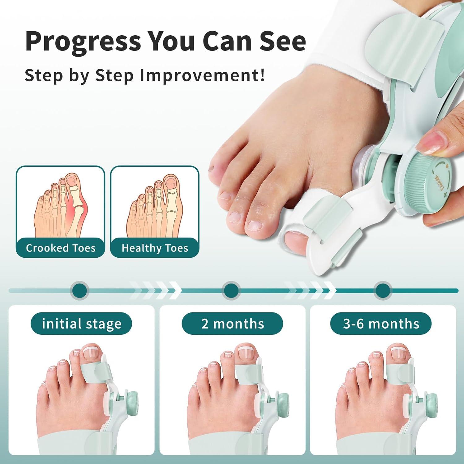 Corrector de Juanetes EliaValth 2 PCS Ajustable Mediana