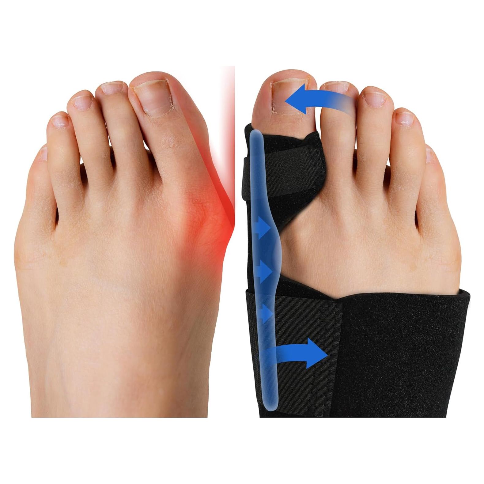 Corrector de Juanetes Fittest Pro - Splint Ortopédico 2 Piezas