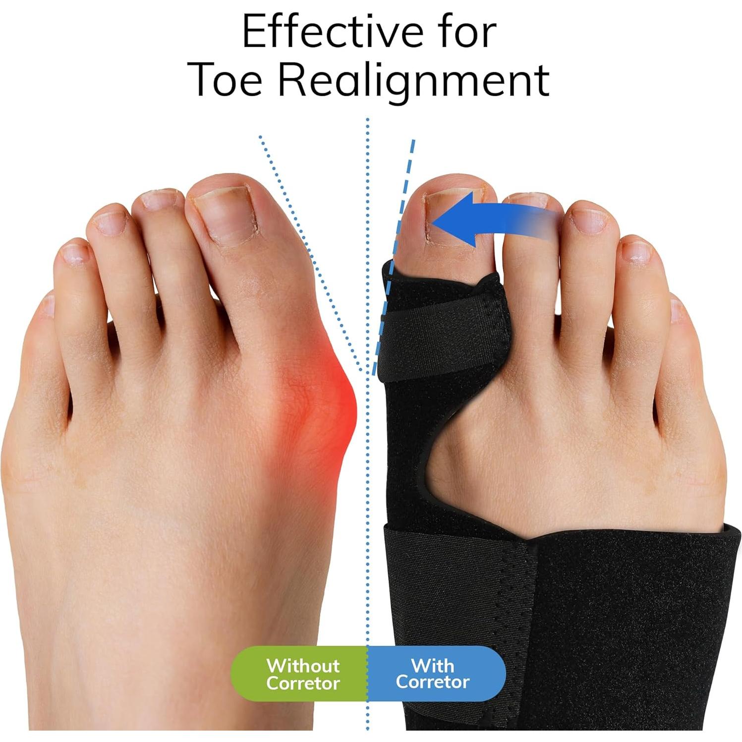Corrector de Juanetes Fittest Pro - Splint Ortopédico 2 Piezas