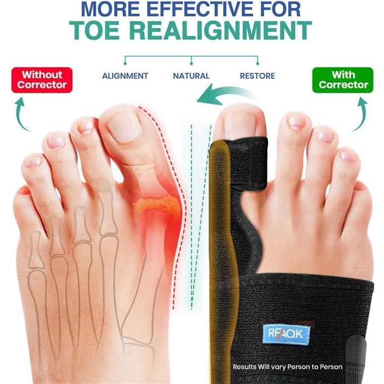 Kit Corrector de Juanetes RFAQK 11 Piezas Unisex