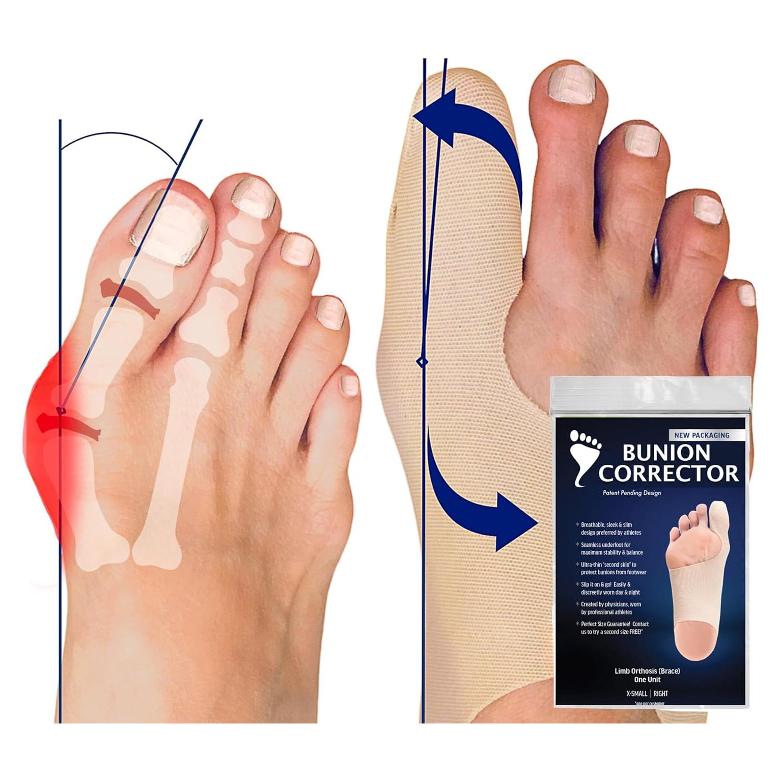 Corrector de Juanetes Bunion Bootie Pie Izquierdo Medio