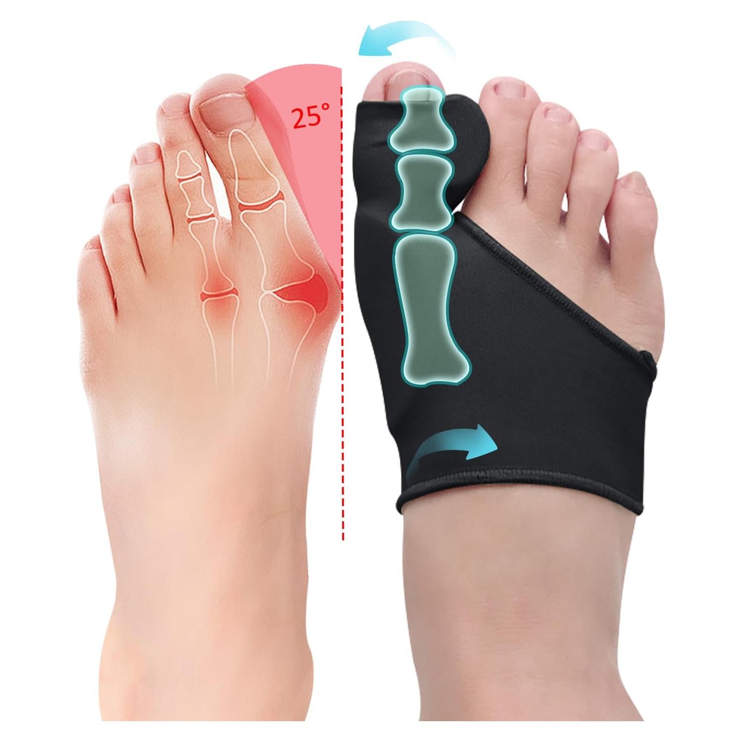 Corrector de Juanetes PGRODE para Mujeres y Hombres - Negro