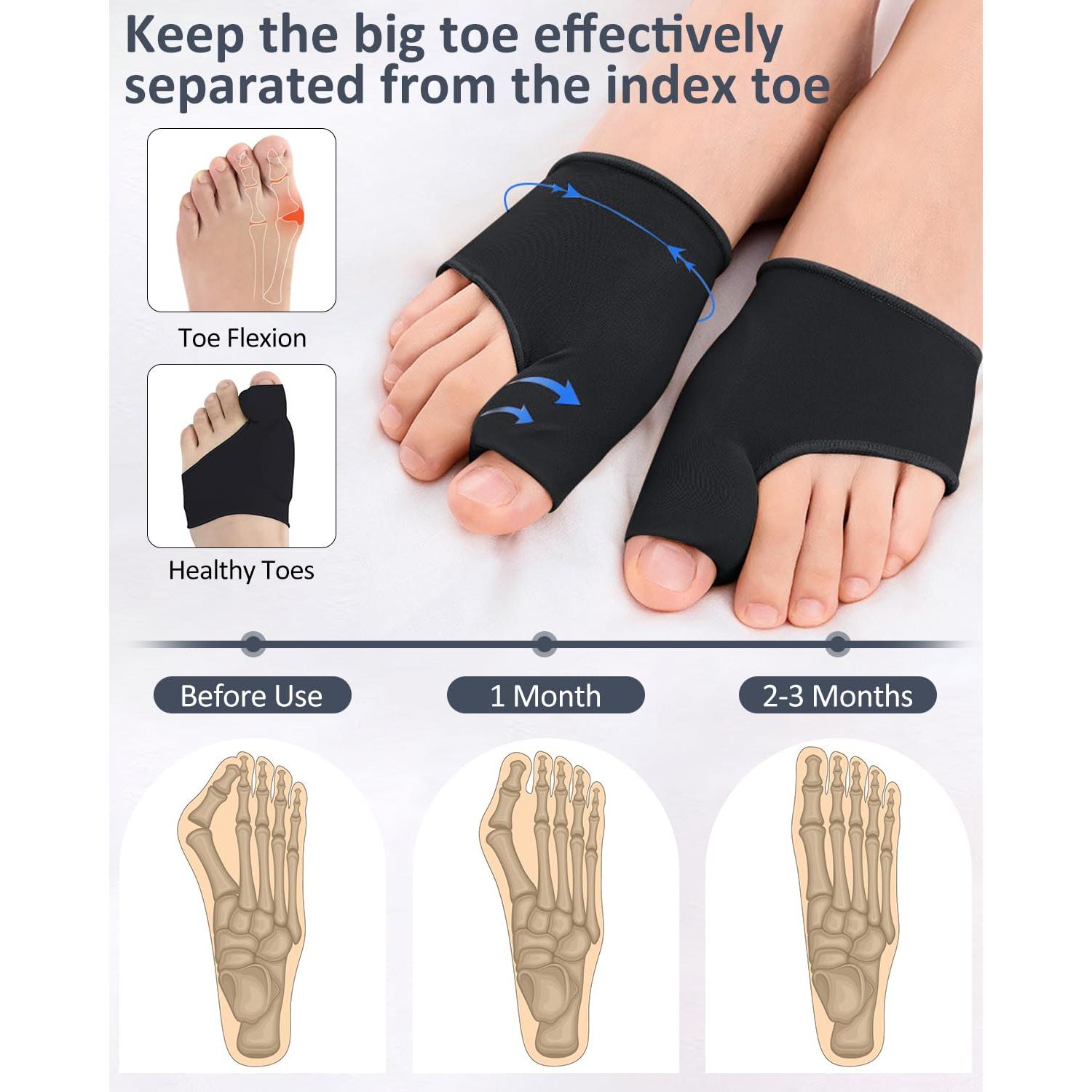 Corrector de Juanetes PGRODE para Mujeres y Hombres - Negro