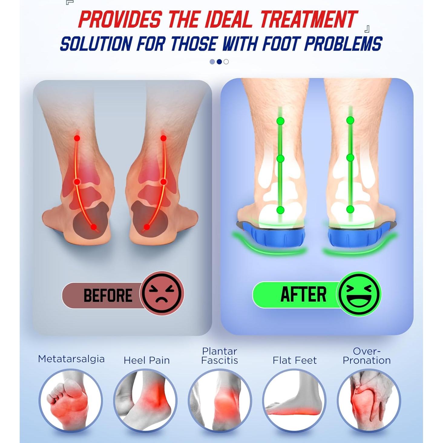 Plantillas ortopédicas NEUPU XL para fascitis plantar
