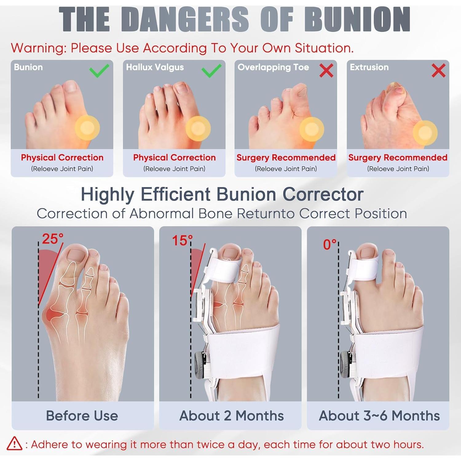 Corrector de Juanetes Ecqizer Ajustable para Dedo Gordo