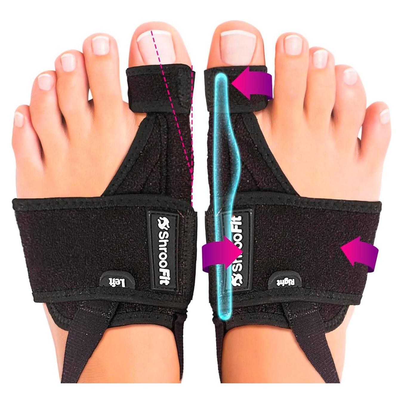 Corrector de Juanetes ShrooFit 2 Paquetes Alivio Duradero