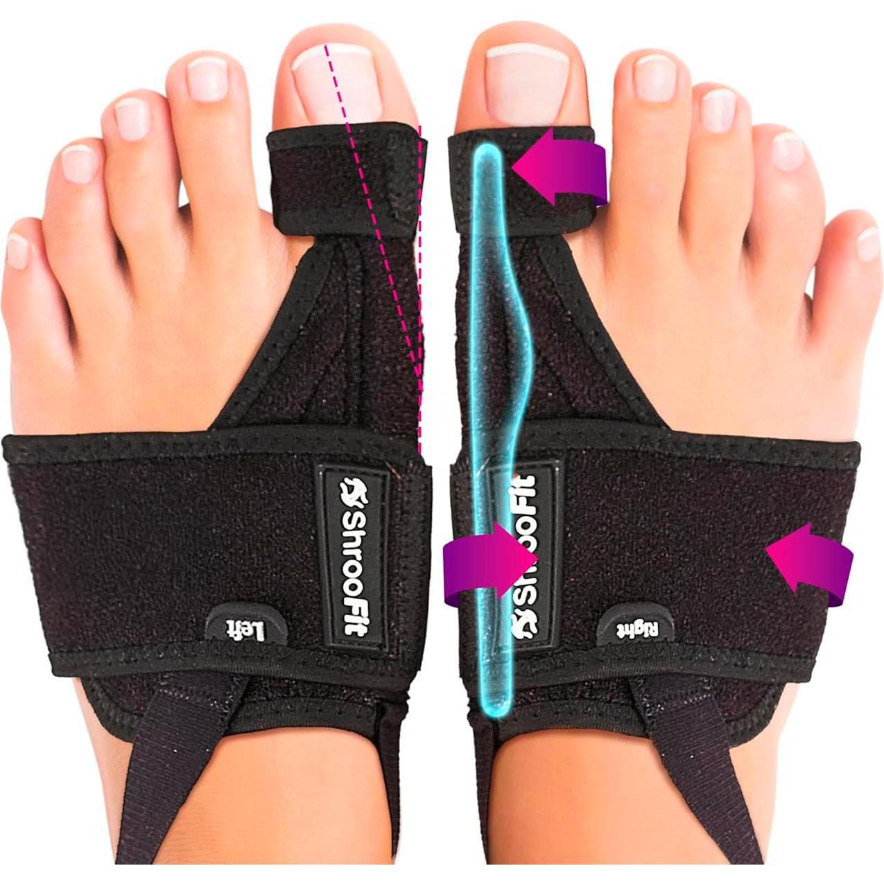 Corrector de Juanetes ShrooFit 2 Paquetes Alivio Duradero