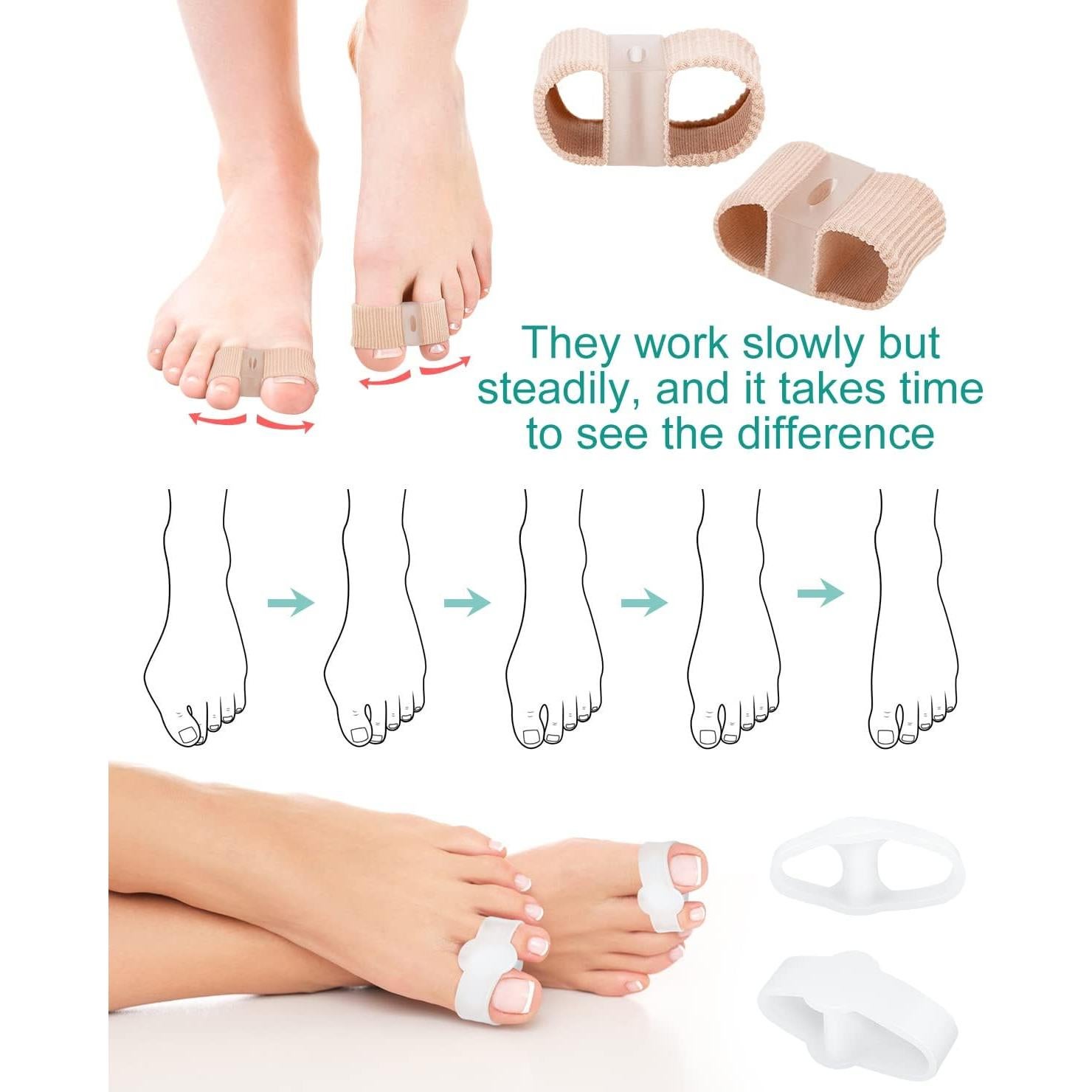 4 Piezas Separadores de Dedos BLATOWN Corrector Juanetes