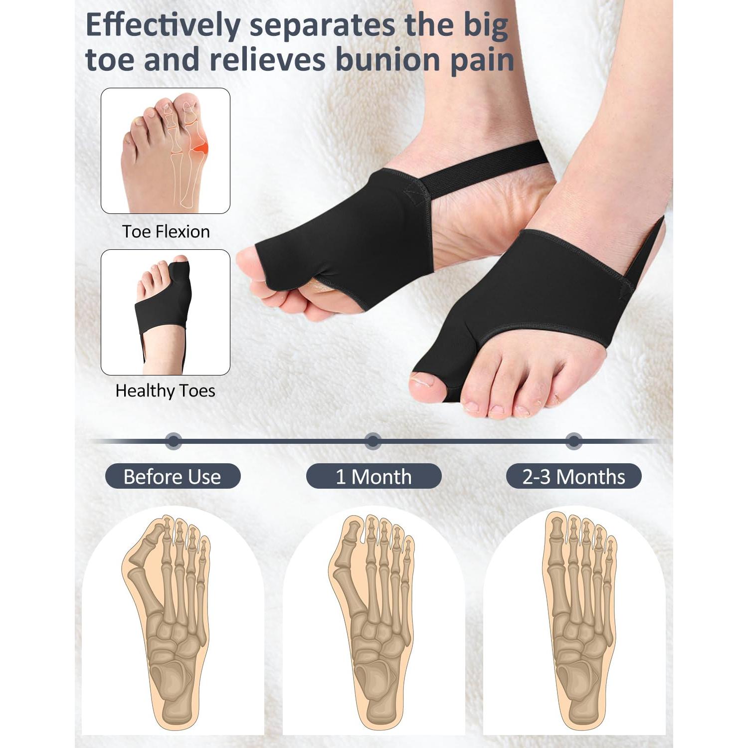 Corrector de Juanetes Hlps-mall 2PC Transpirable con Gel