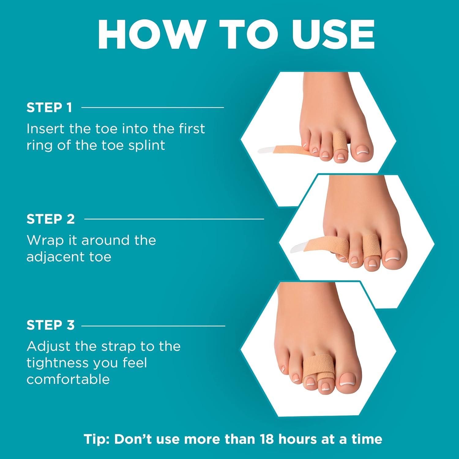 Corrector de dedos en martillo Homergy 4 unidades beige