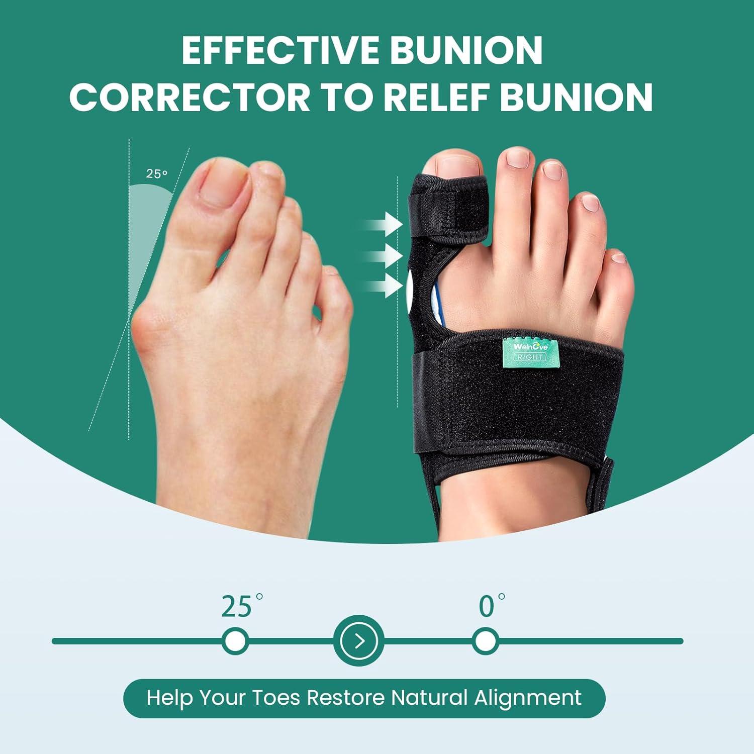 Corrector de Juanetes Welnove - Férula Ortopédica 2 Unidades