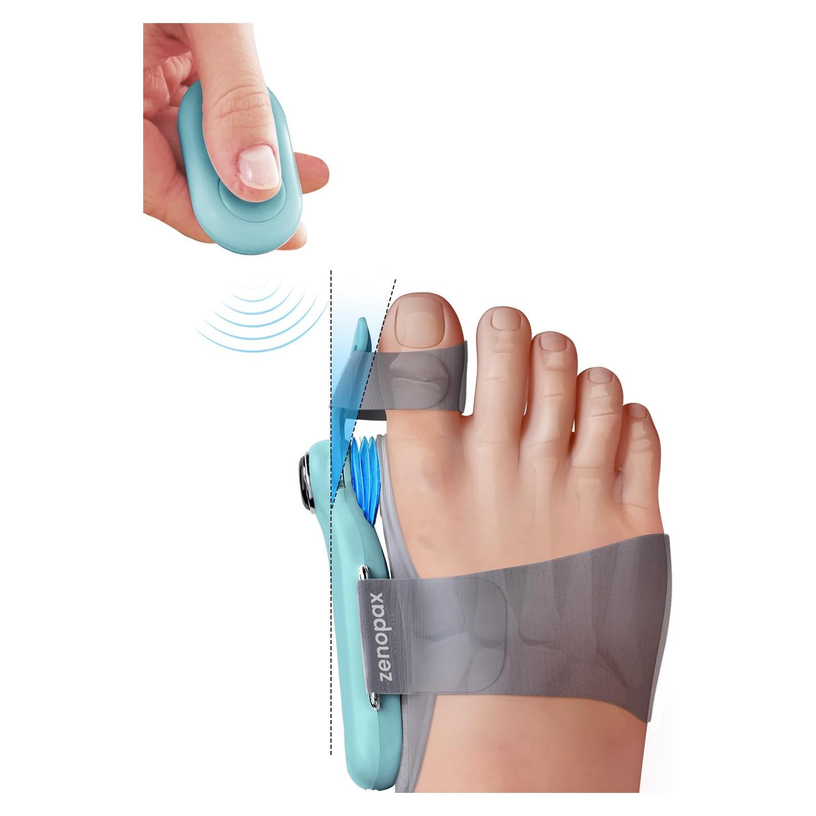 Corrector de Juanetes Eléctrico Zenopax Ajustable Recargable