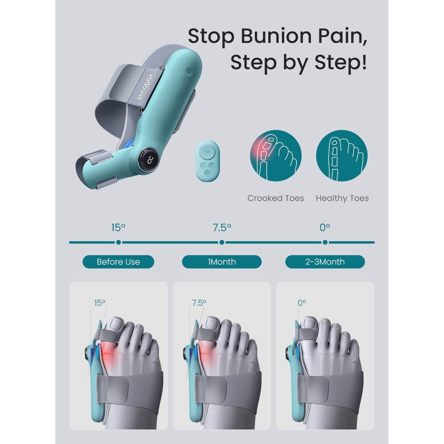 Corrector de Juanetes Eléctrico Zenopax Ajustable Recargable