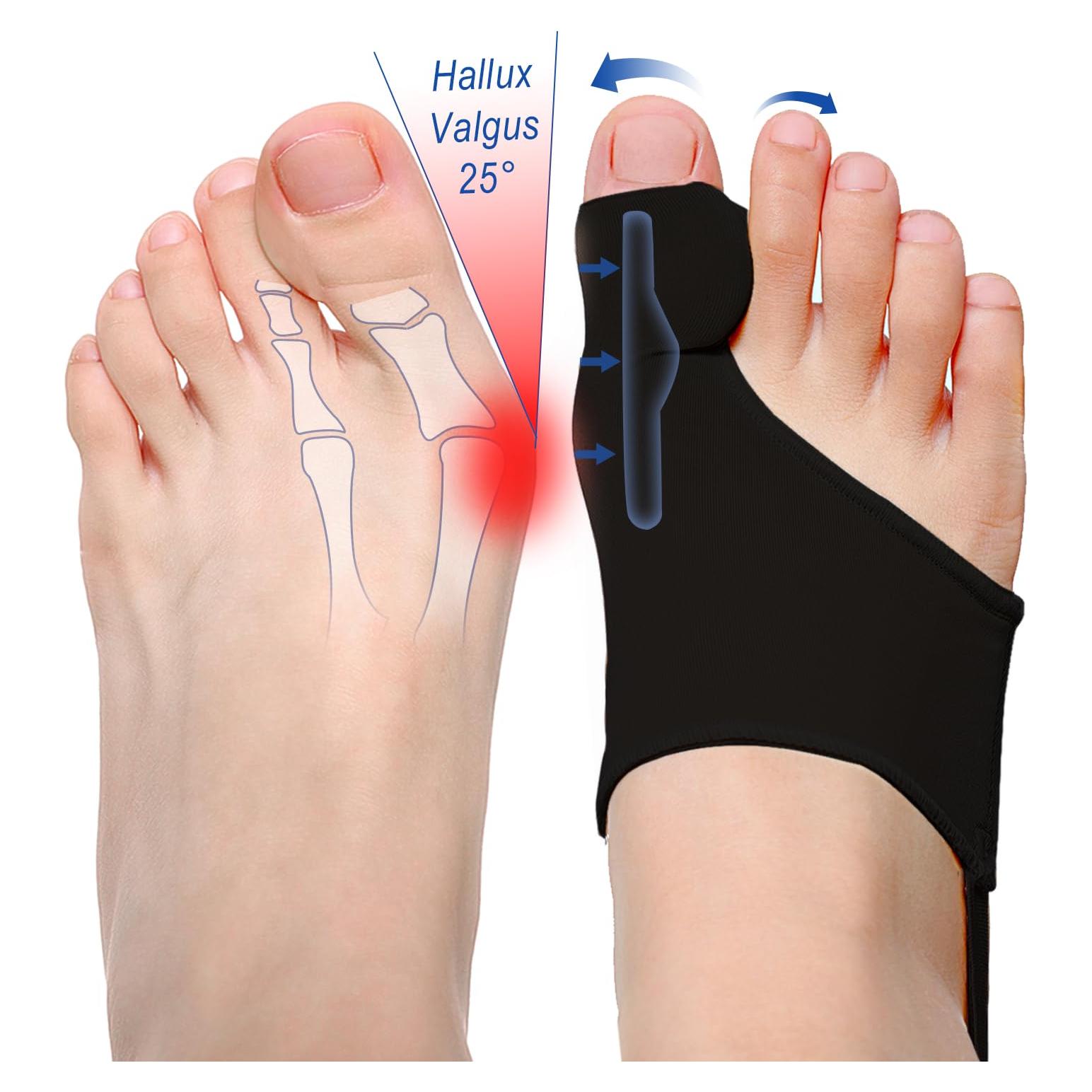 Corrector de Juanetes ELFON para Mujeres - Alivio Hallux Valgus