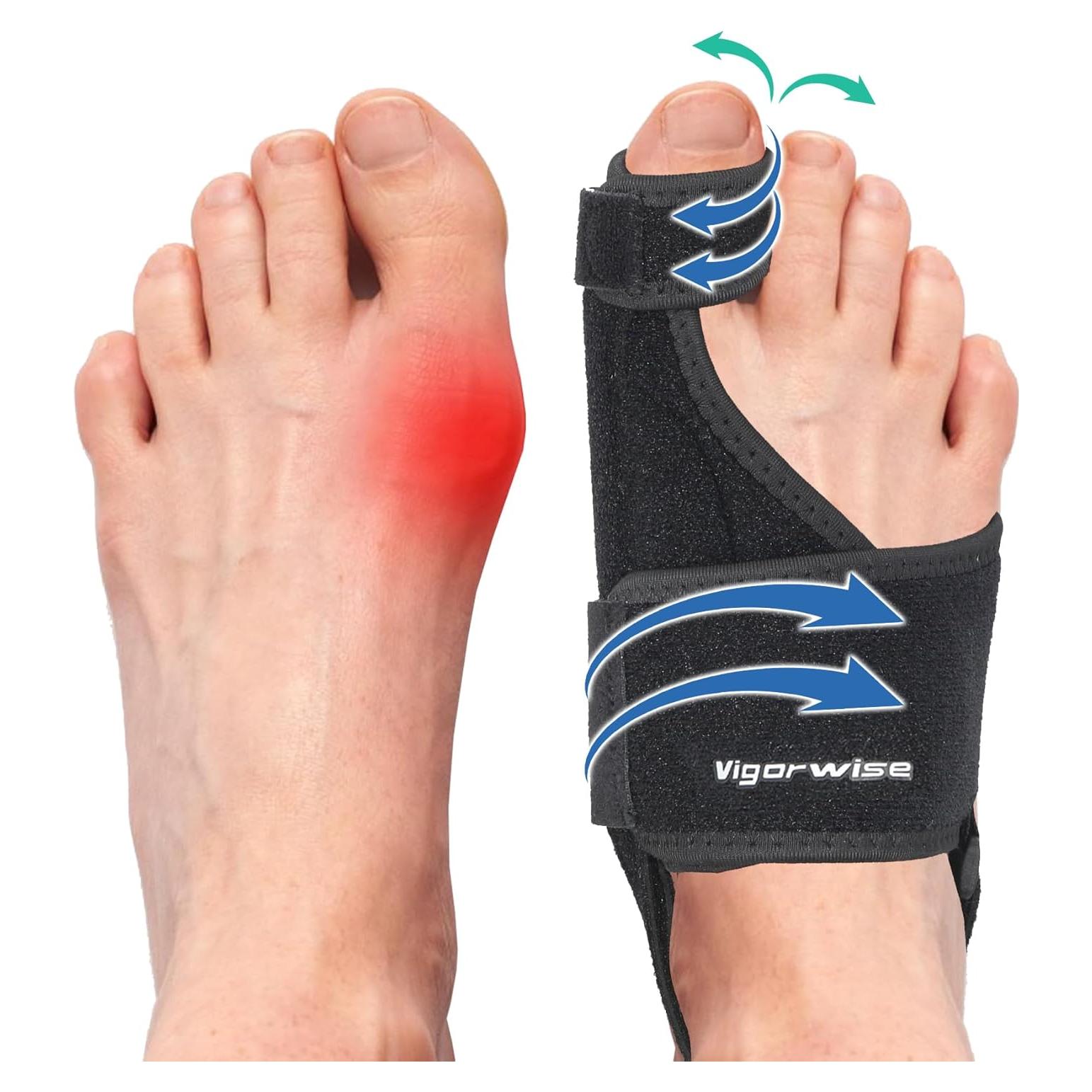 Corrector de Juanetes Vigorwise 2 Piezas Aluminio Ajustable