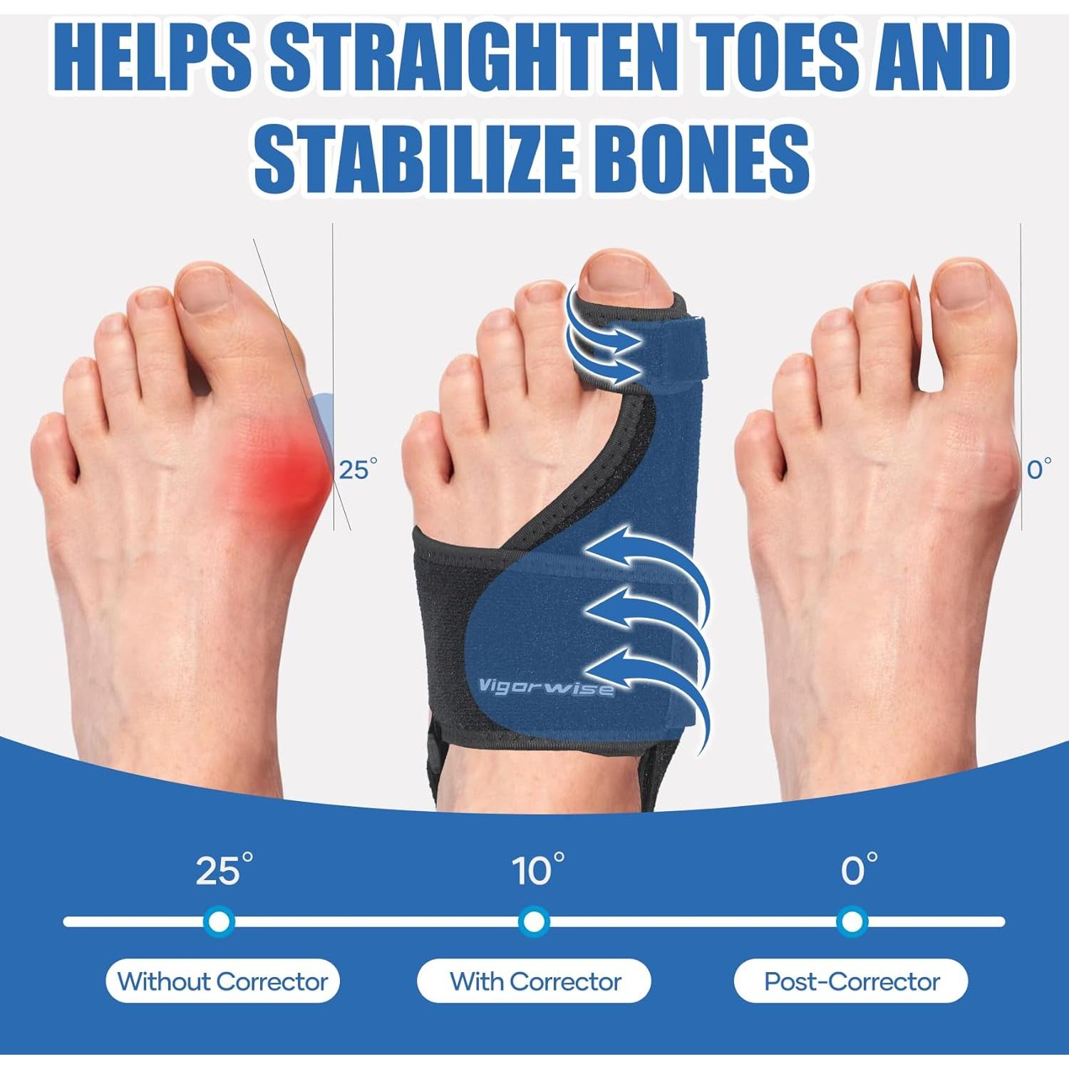 Corrector de Juanetes Vigorwise 2 Piezas Aluminio Ajustable