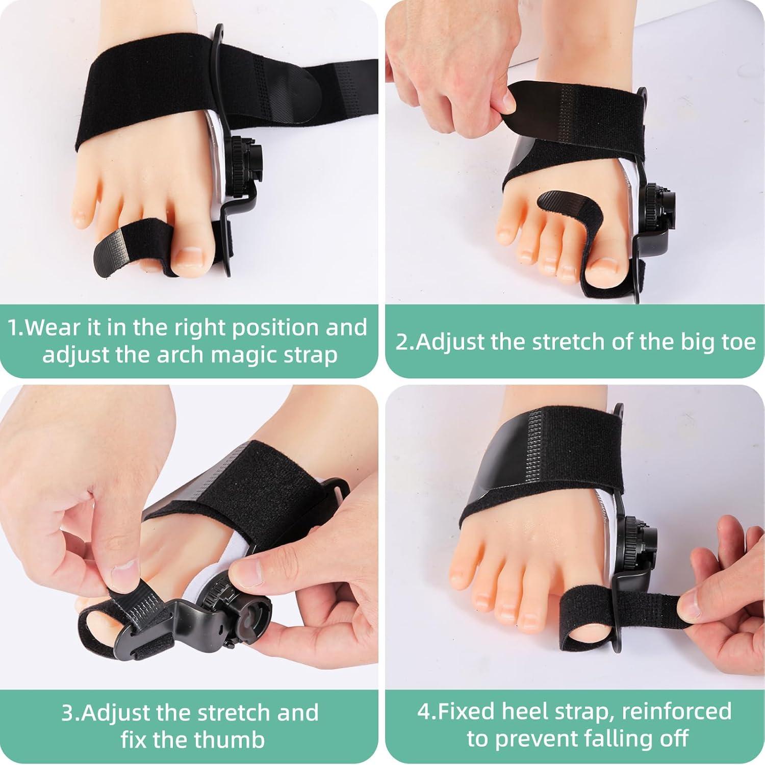 Corrector de Juanetes Ajustable FMGJKQL para Hombres y Mujeres