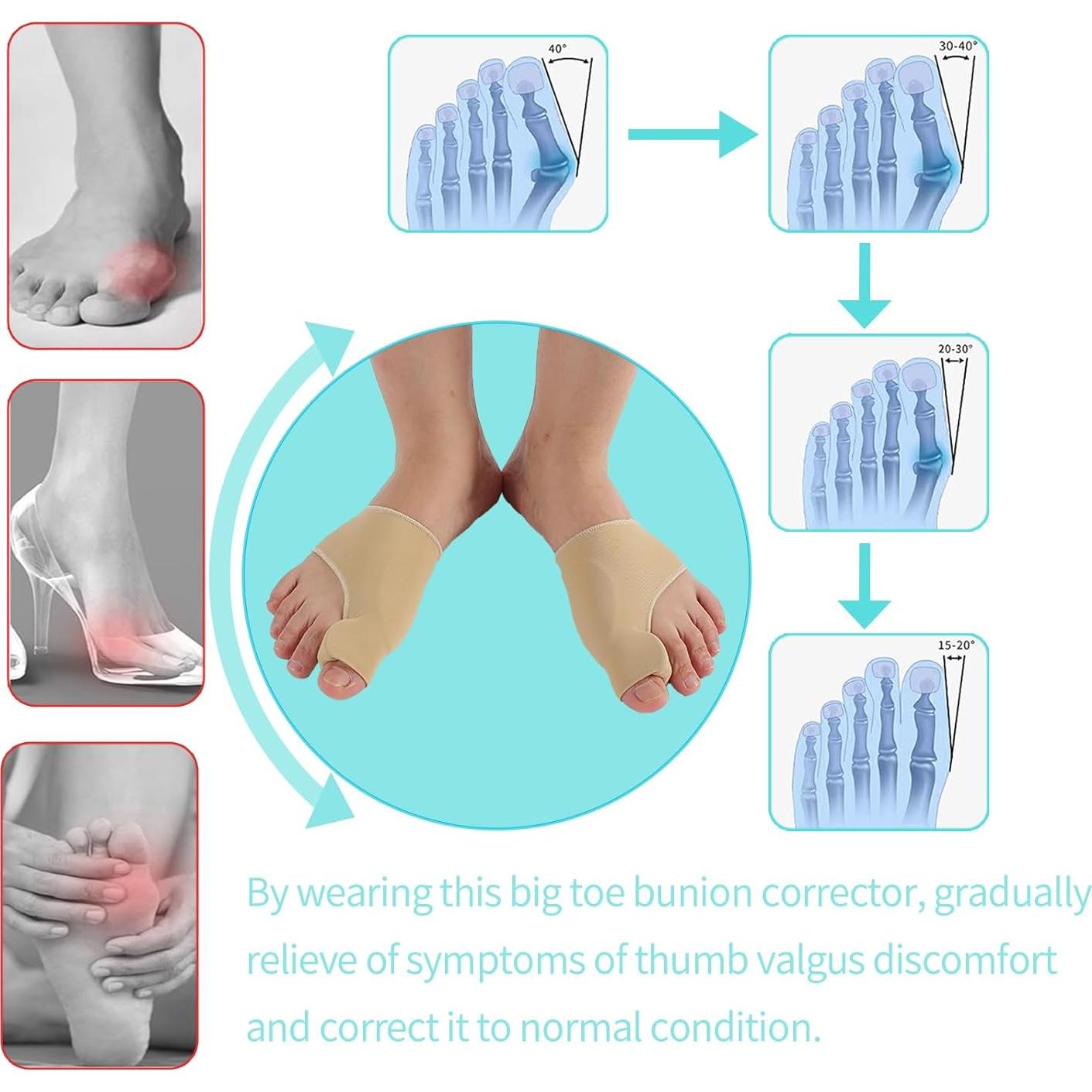 Calcetines Correctores de Juanetes Shengchuang Pequeño Caqui