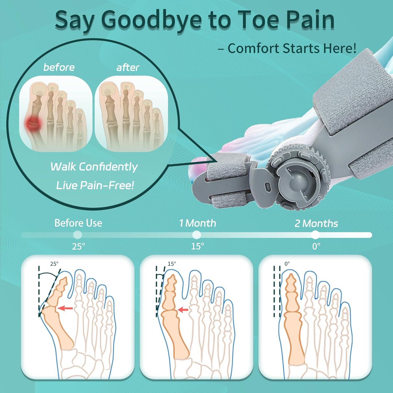 Corrector de Juanetes Ajustable Veook Gris para Pies