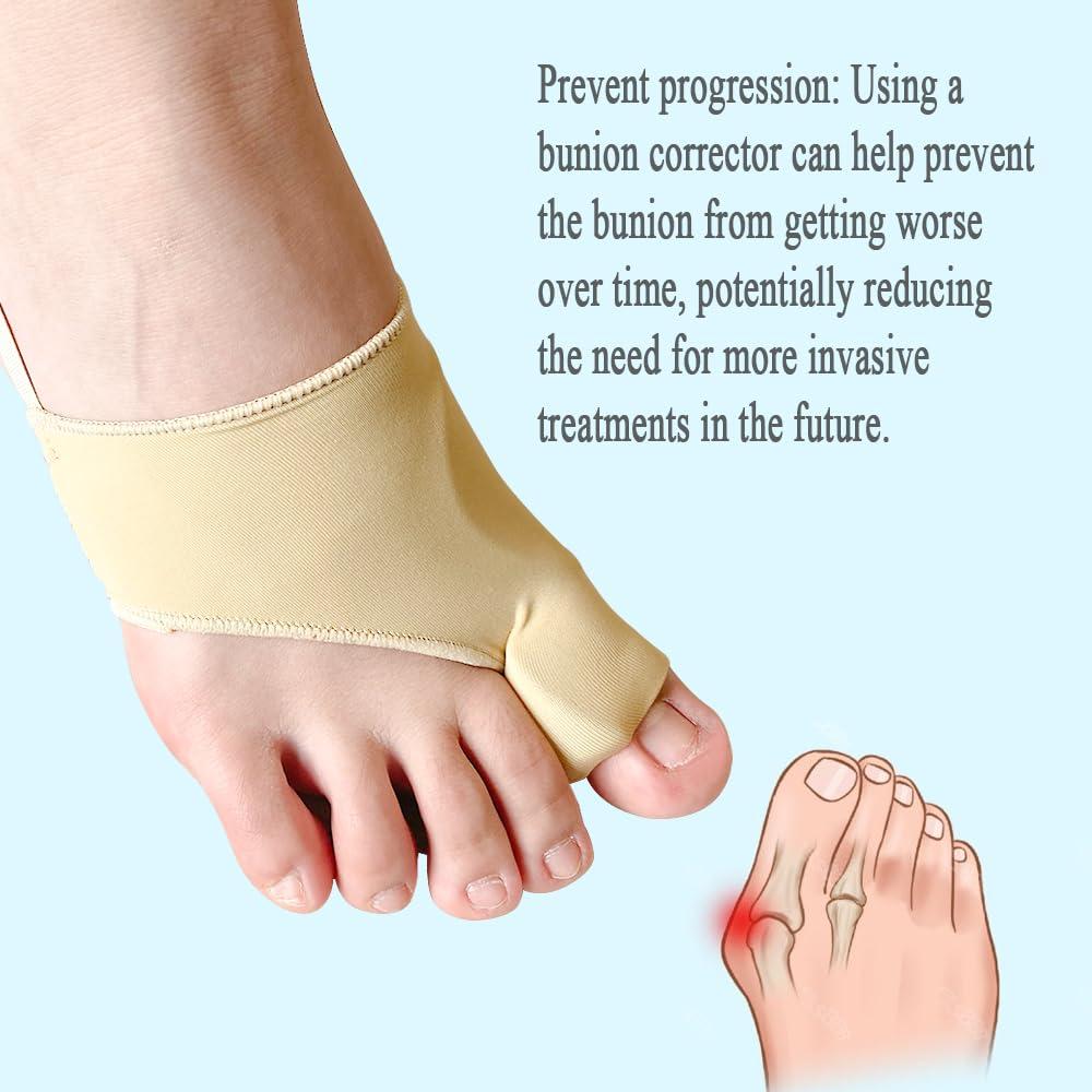 Corrector de Juanetes Qxotvzy Beige para Alivio del Dolor