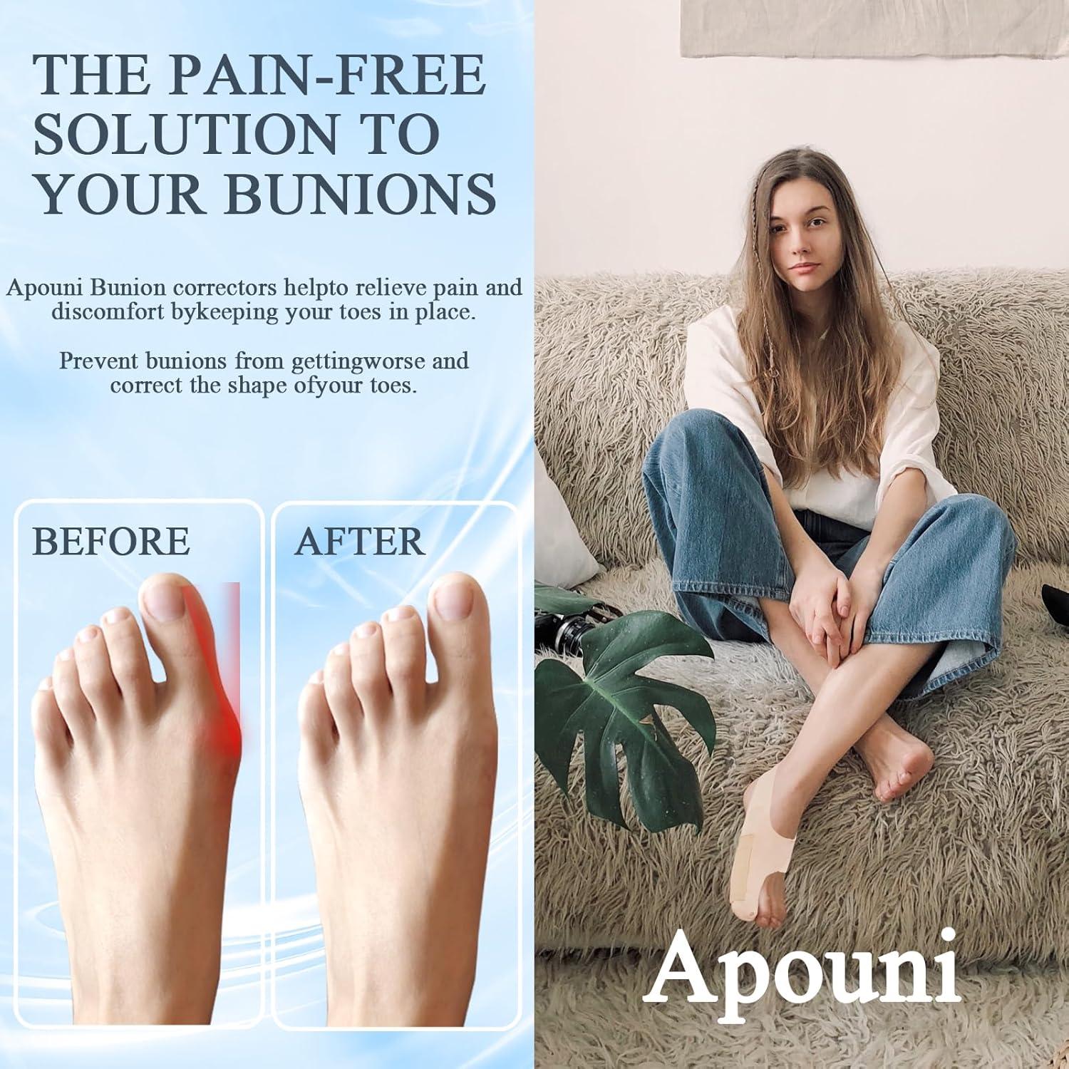 Corrector de Juanetes Ajustable Wuyiyi Tamaño Mediano