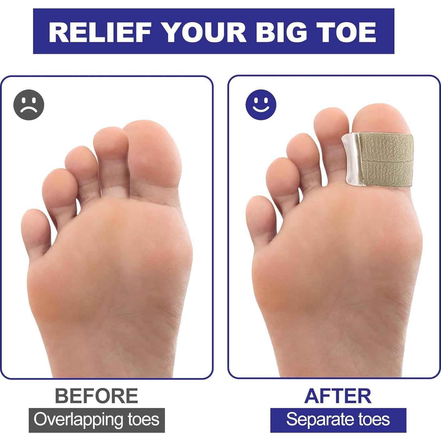 Separadores de Dedos de Gel Szemauy para Juanetes - 6 Piezas