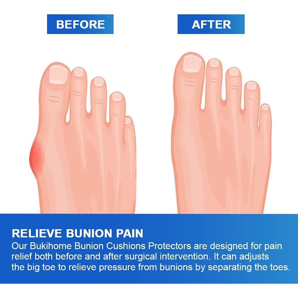 Protectores de Almohadillas para Juanetes Bukihome 10 Pzas