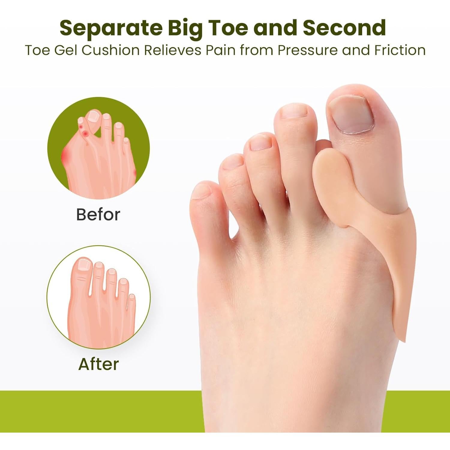 Almohadillas Correctoras para Juanetes Bukihome - 8 Piezas