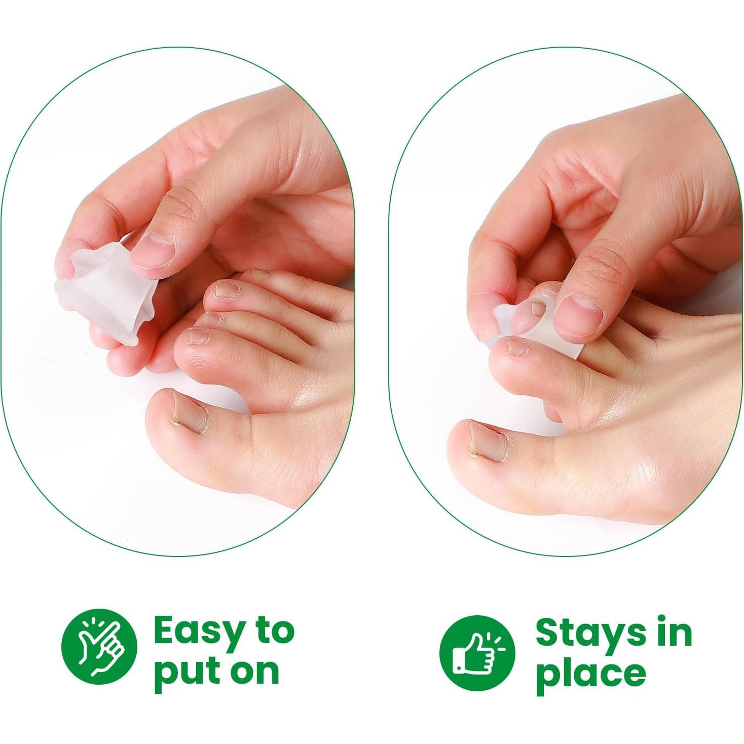 Corrector de Dedo en Martillo Bukihome - 6 Enderezadores Medianos