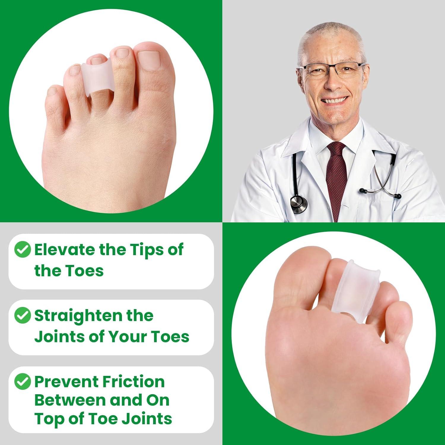 Corrector de Dedo en Martillo Bukihome - 6 Enderezadores Medianos