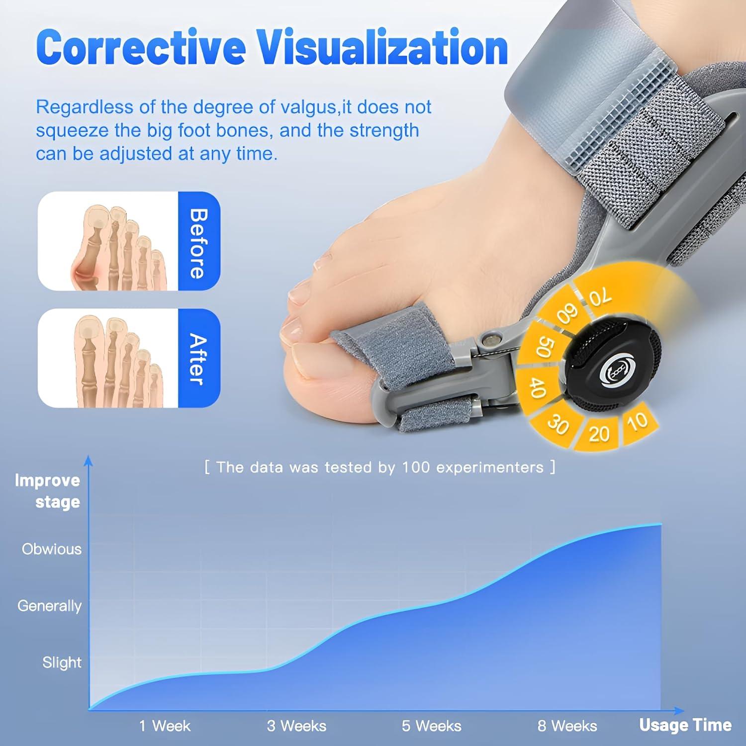 Corrector de Juanetes Qlonn Ajustable para Hombres y Mujeres