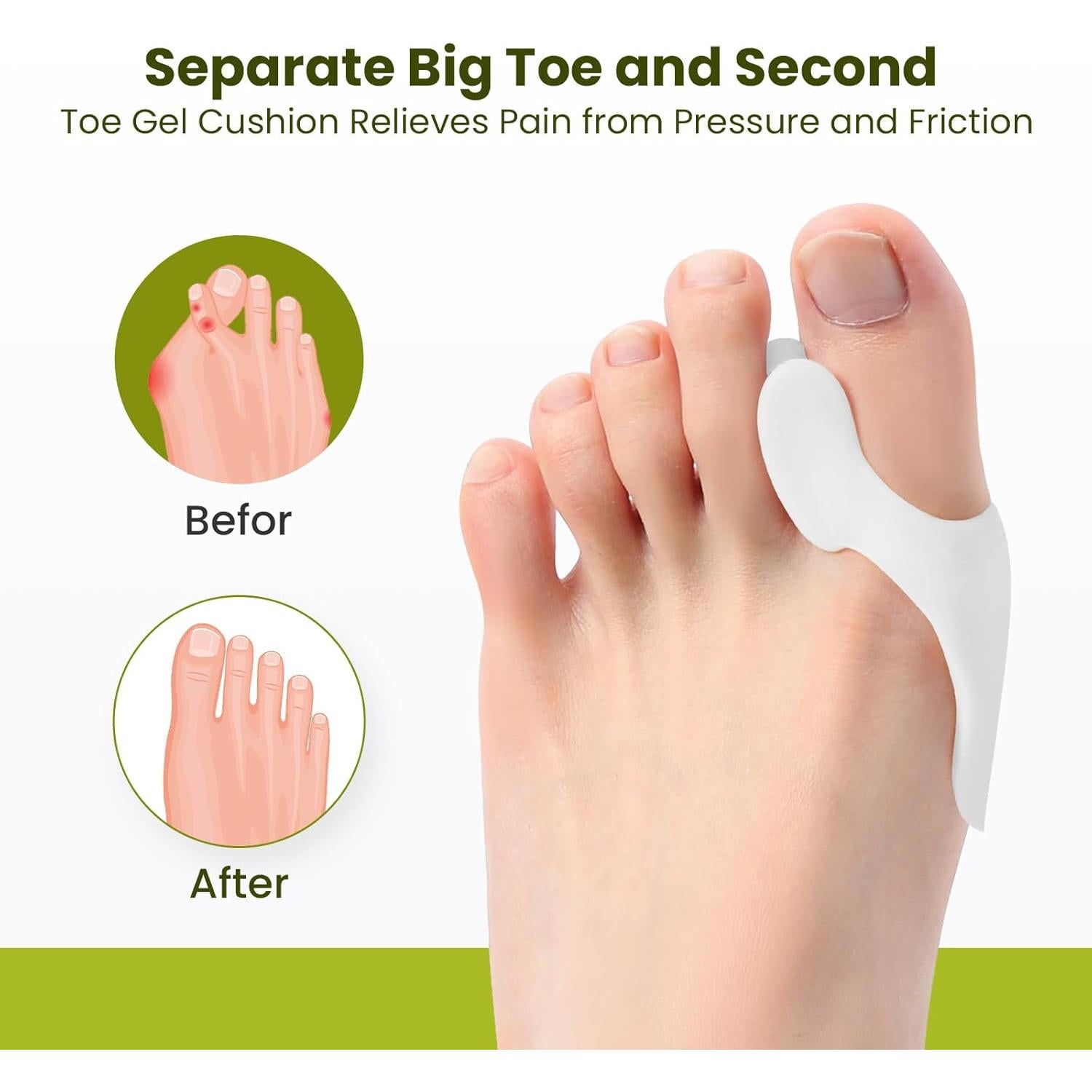 Protector de Almohadilla para Juanetes Bukihome - 8 Pzas Gel