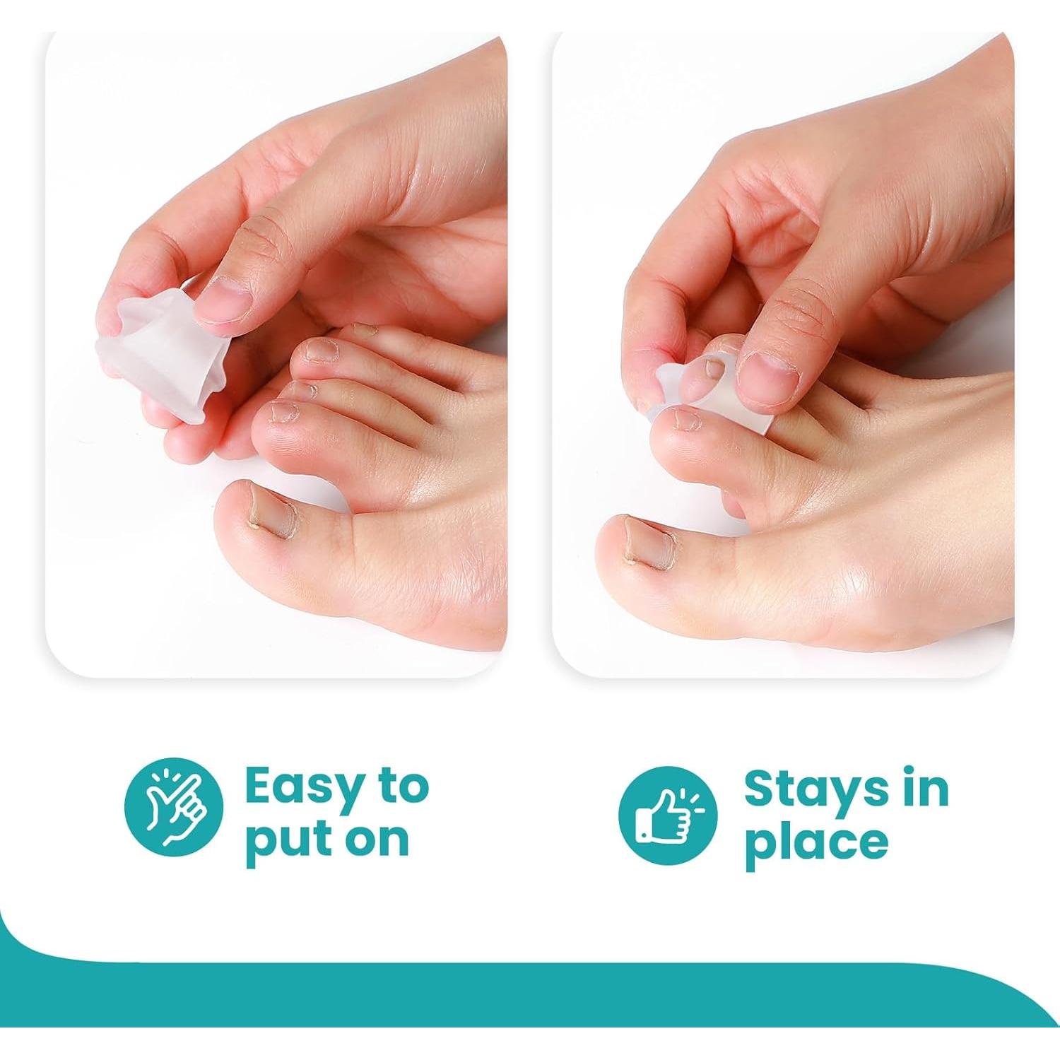 Corrector de Dedos en Garra Promifun - 8 Piezas Mediano