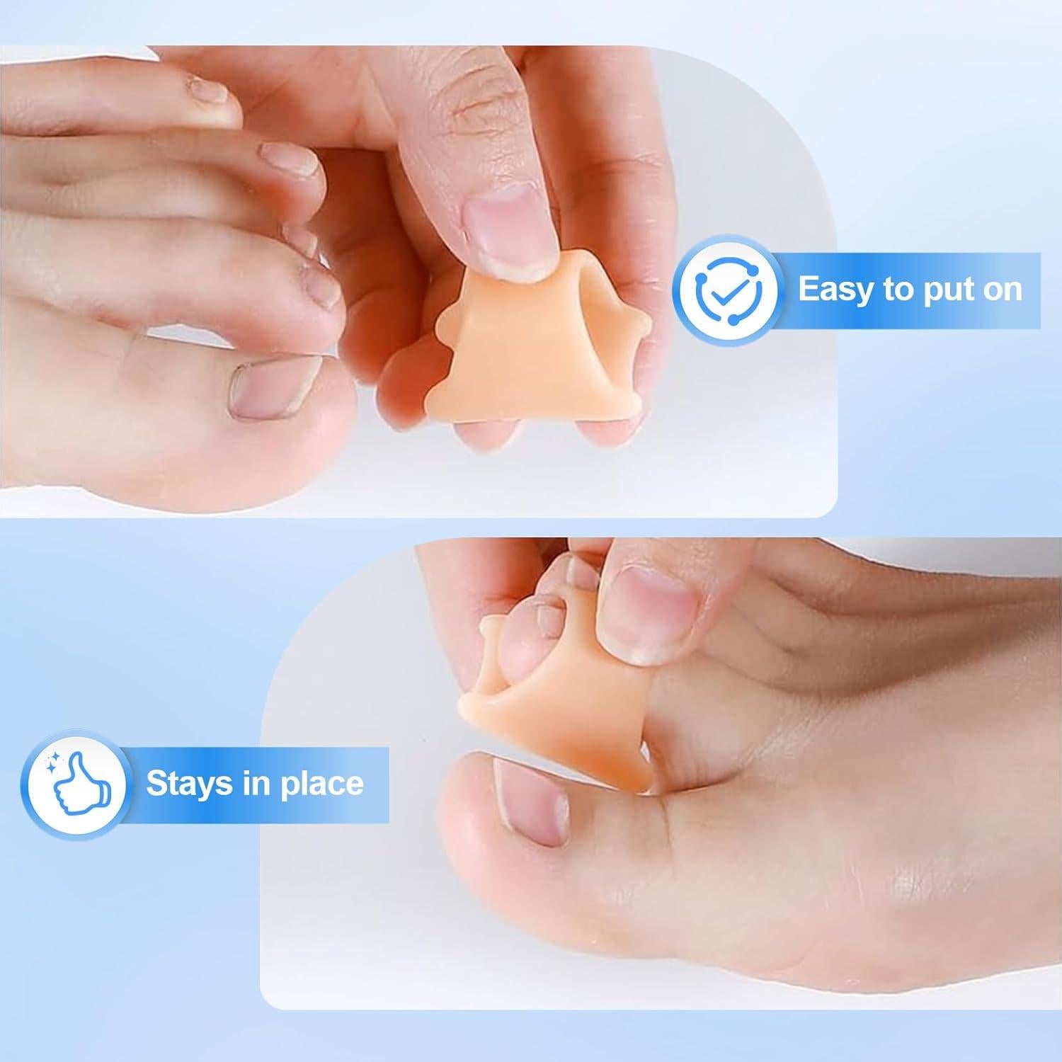 Corrector de Dedo en Martillo Heqxwl Pequeño 6 Piezas