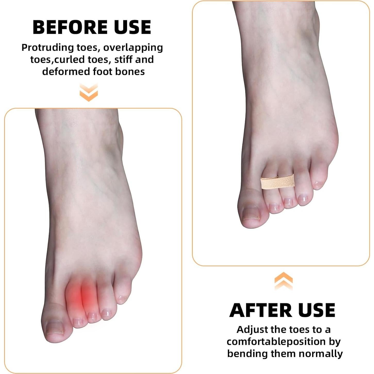 10 Férulas para Dedos Buddy JFHNMLW Reutilizables Negro Beige