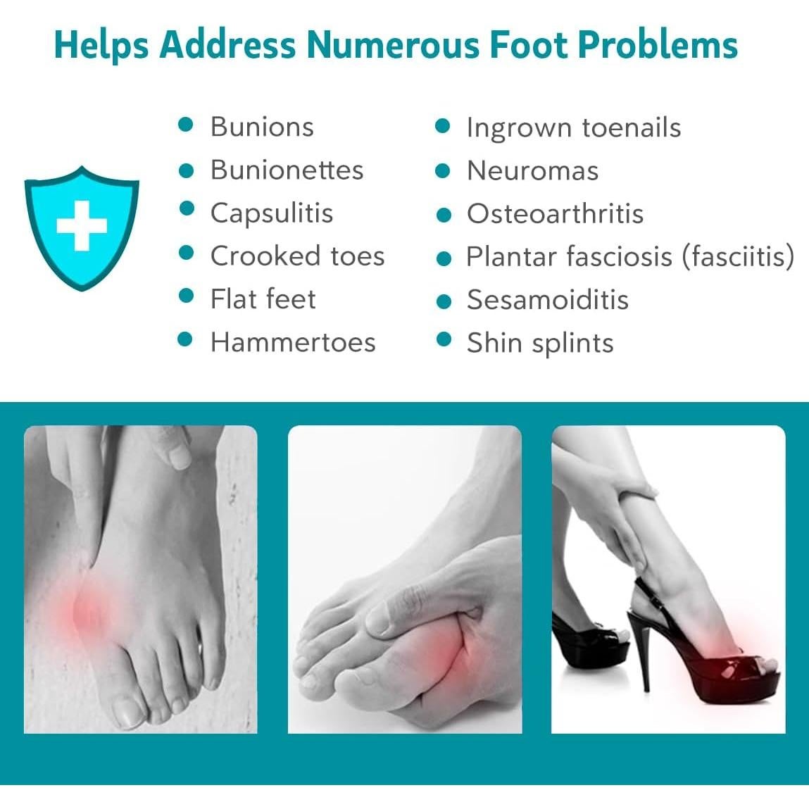 Separadores de Dedos Correctores de Juanetes KIYOKI - Unisex