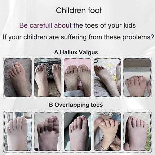 Separadores de Dedos de Gel Consysi para Niños 9,29x6,30cm