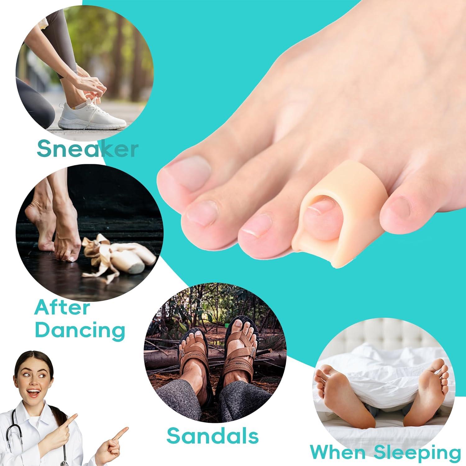 Corrector de Dedo en Garra Byehambuni, 6 Piezas Pequeñas Beige