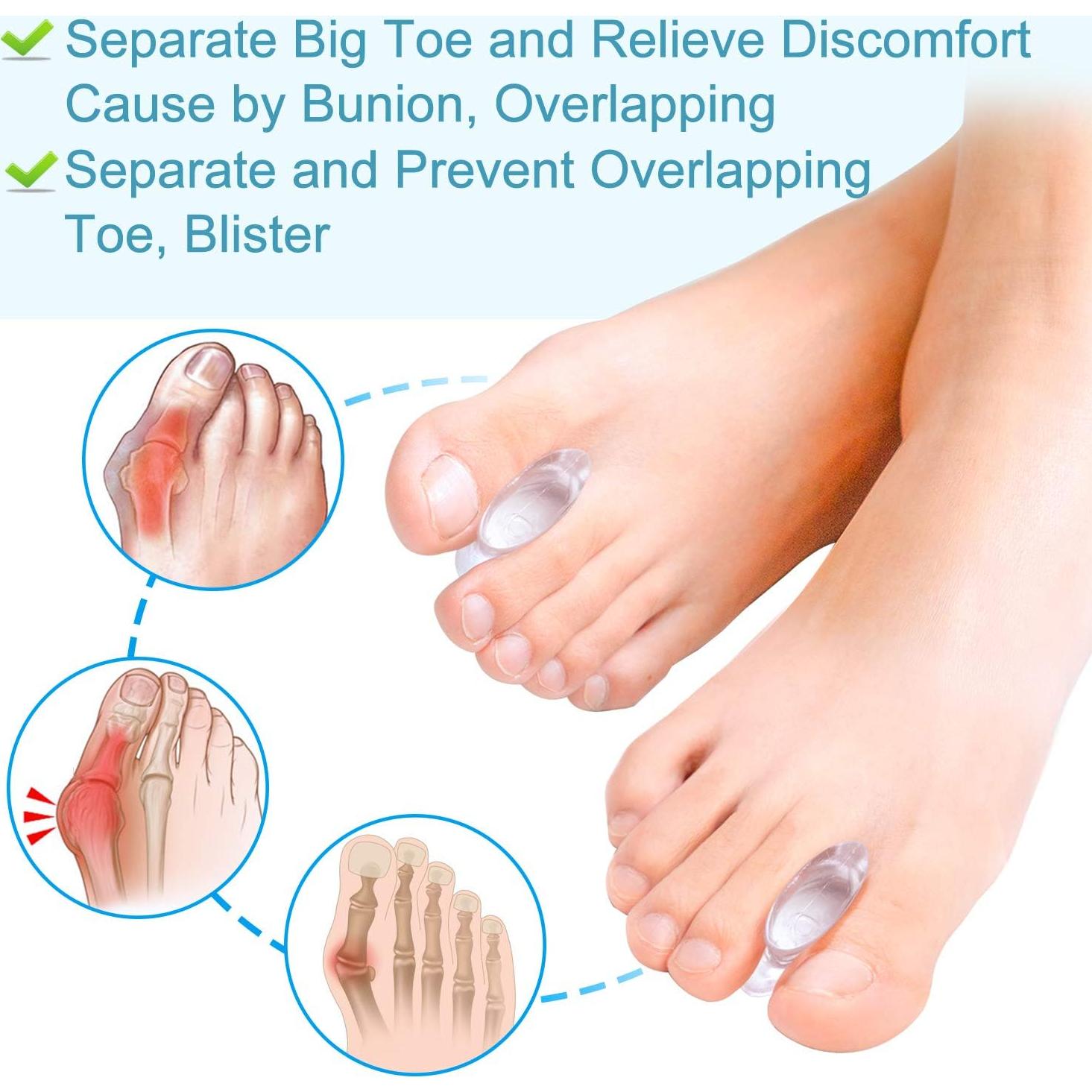 Corrector de Juanetes de Gel Povihome 10 Paquetes Grande