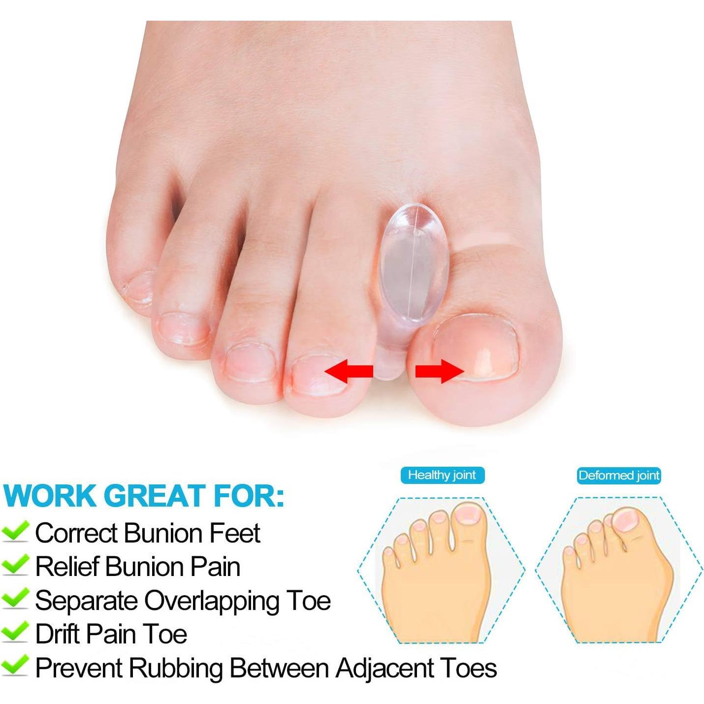 Corrector de Juanetes de Gel Povihome 10 Paquetes Grande