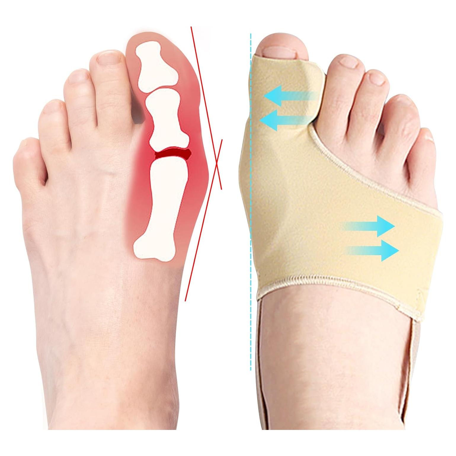 Corrector de Juanetes DFQ 2 Pcs para Hombres y Mujeres M