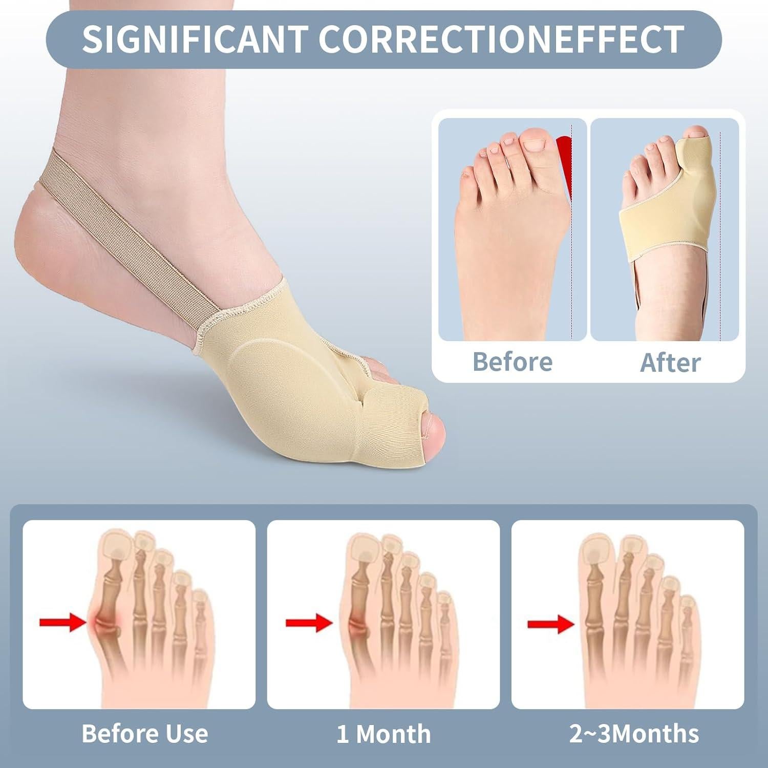 Corrector de Juanetes DFQ 2 Pcs para Hombres y Mujeres M